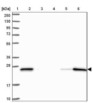 Western Blot: D4-GDI/RhoGDI2 Antibody [NBP2-33608]