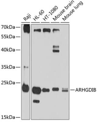 Western Blot: D4-GDI/RhoGDI2 AntibodyBSA Free [NBP2-92431]