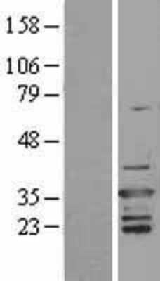 Western Blot: D4-GDI/RhoGDI2 Overexpression Lysate [NBL1-07674]