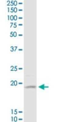 Western Blot: D4S234E Antibody (1C3) [H00027065-M01]