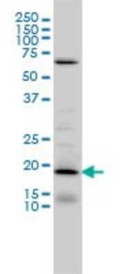 Western Blot: D4S234E Antibody (1C3) [H00027065-M01]