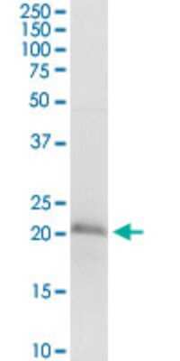 Western Blot: D4S234E Antibody (1C3) [H00027065-M01]