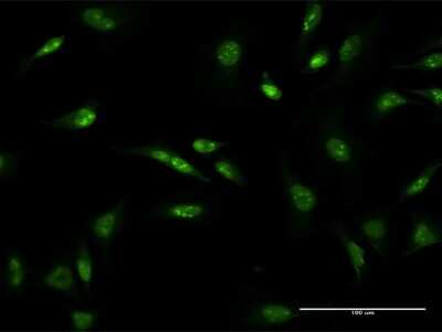 Immunocytochemistry/ Immunofluorescence: D4S234E Antibody (1D22) [H00027065-M03]