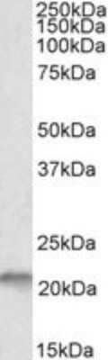 Western Blot: D4S234E Antibody [NBP2-26148]