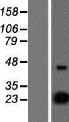 Western Blot: D4S234E Overexpression Lysate [NBP2-07345]