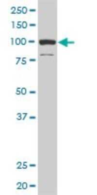 Western Blot: DAAM1 Antibody (4H3) [H00023002-M03]
