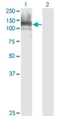 Western Blot: DAAM1 Antibody (4H3) [H00023002-M03]