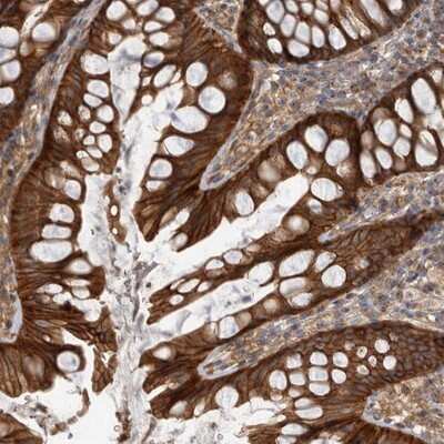 Immunohistochemistry-Paraffin: DAAM1 Antibody [NBP1-81492]