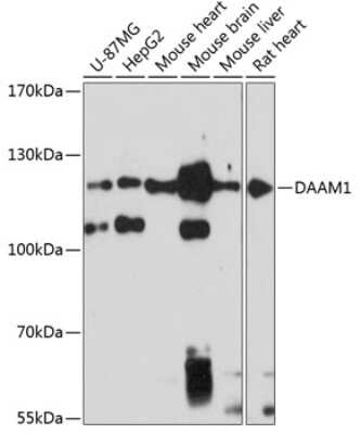 Western Blot: DAAM1 AntibodyAzide and BSA Free [NBP2-92096]