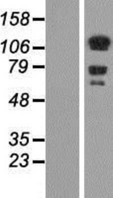 Western Blot: DAAM1 Overexpression Lysate [NBP2-07237]