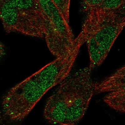 Immunocytochemistry/ Immunofluorescence: DAAM2 Antibody [NBP2-49141]