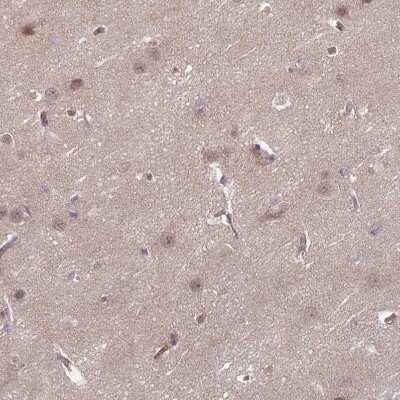 Immunohistochemistry-Paraffin: DAAM2 Antibody [NBP2-47496]
