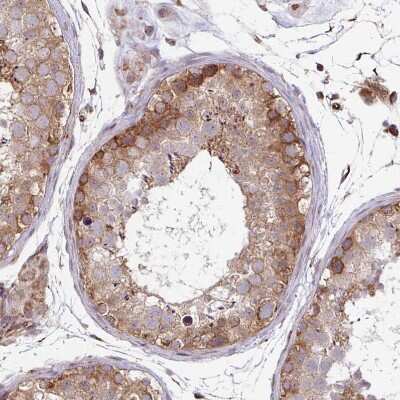 Immunohistochemistry-Paraffin: DAAM2 Antibody [NBP2-47496]
