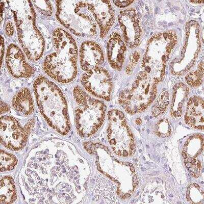 Immunohistochemistry-Paraffin: DAAM2 Antibody [NBP2-49141]
