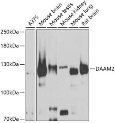 Western Blot: DAAM2 AntibodyBSA Free [NBP2-92809]