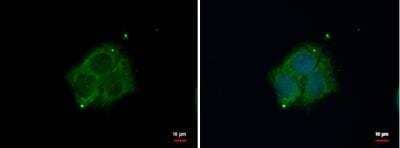 Immunocytochemistry/ Immunofluorescence: DAB1 Antibody [NBP2-16095]