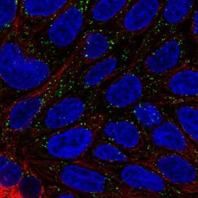 Immunocytochemistry/ Immunofluorescence: DAB1 Antibody [NBP2-57001]