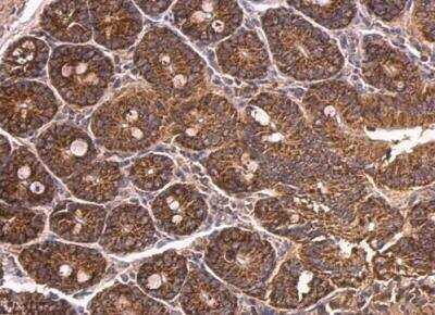 Immunohistochemistry-Paraffin: DAB1 Antibody [NBP2-16095]
