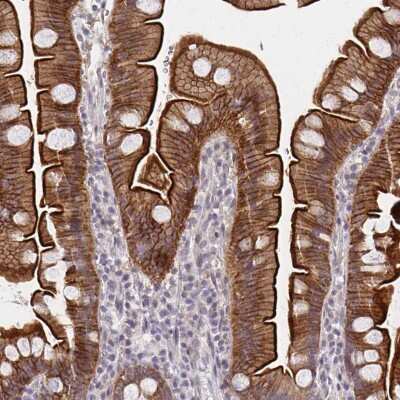 Immunohistochemistry-Paraffin: DAB1 Antibody [NBP2-38661]