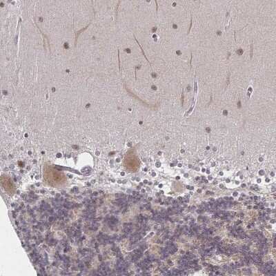 Immunohistochemistry-Paraffin: DAB1 Antibody [NBP2-38661]