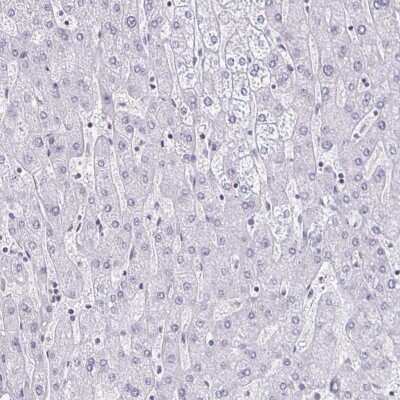 Immunohistochemistry-Paraffin: DAB1 Antibody [NBP2-38661]