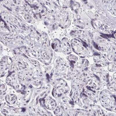 Immunohistochemistry-Paraffin: DAB1 Antibody [NBP2-38661]