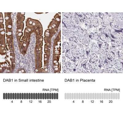 Immunohistochemistry-Paraffin: DAB1 Antibody [NBP2-38661]