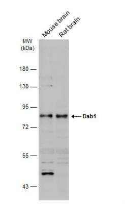 Western Blot: DAB1 Antibody [NBP2-16095]