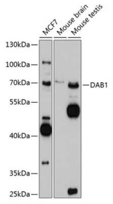 Western Blot: DAB1 AntibodyAzide and BSA Free [NBP2-92015]