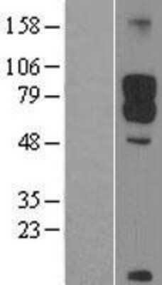 Western Blot: DAB1 Overexpression Lysate [NBL1-09709]