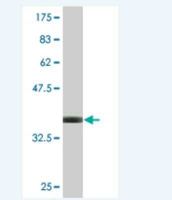 Western Blot: DAB2 Antibody (1C8) [H00001601-M06]