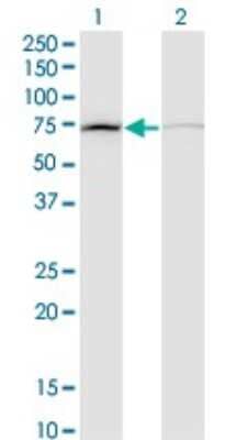 Western Blot: DAB2 Antibody (3D6) [H00001601-M09]