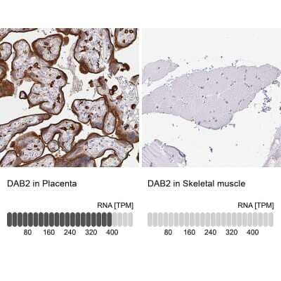 Immunohistochemistry-Paraffin: DAB2 Antibody [NBP2-33915]