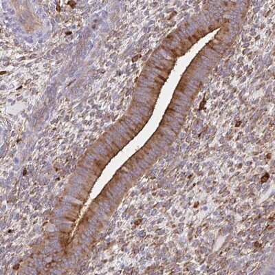 Immunohistochemistry-Paraffin: DAB2 Antibody [NBP2-33915]
