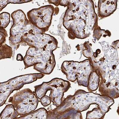 Immunohistochemistry-Paraffin: DAB2 Antibody [NBP2-33915]