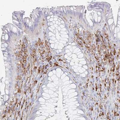 Immunohistochemistry-Paraffin: DAB2 Antibody [NBP2-33915]