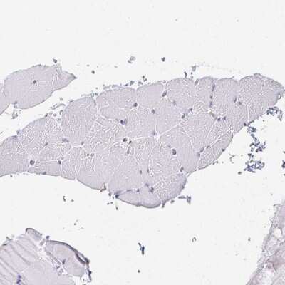 Immunohistochemistry-Paraffin: DAB2 Antibody [NBP2-33915]