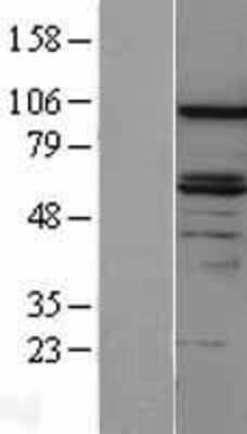 Western Blot: DAB2 Overexpression Lysate [NBL1-09710]