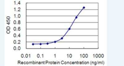 ELISA: DAB2IP Antibody (8C10) [H00153090-M04-100ug]