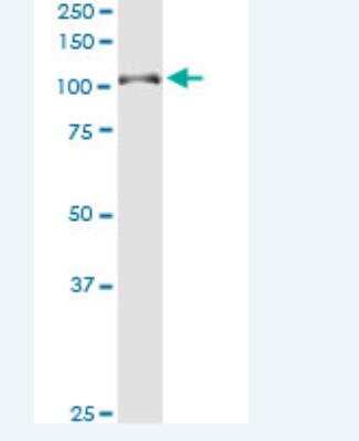 Western Blot: DAB2IP Antibody (8C10) [H00153090-M04-100ug]