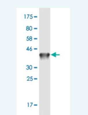 Western Blot: DAB2IP Antibody (8C10) [H00153090-M04-100ug]