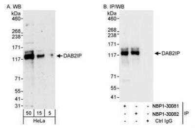Western Blot: DAB2IP Antibody [NBP1-30081]