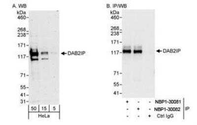 Western Blot: DAB2IP Antibody [NBP1-30082]