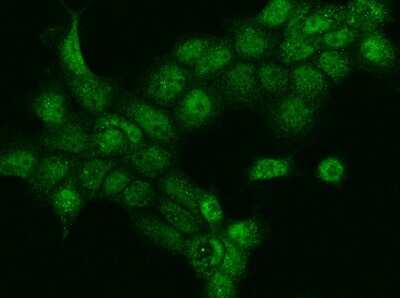 Immunocytochemistry/ Immunofluorescence: DACH1 Antibody [NBP3-06643]