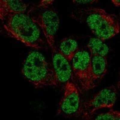 Immunocytochemistry/ Immunofluorescence: DACH1 Antibody [NBP3-17784]