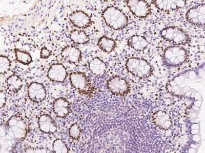 Immunohistochemistry: DACH1 Antibody [NBP3-06643]