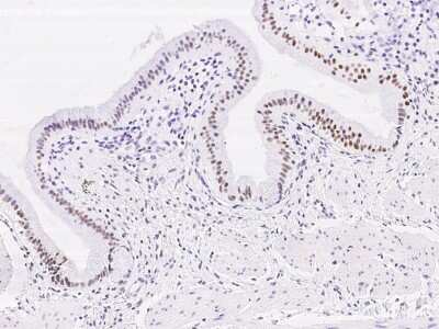 Immunohistochemistry: DACH1 Antibody [NBP3-06643]