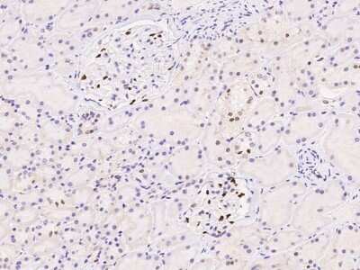 Immunohistochemistry: DACH1 Antibody [NBP3-06643]