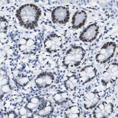 Immunohistochemistry-Paraffin: DACH1 Antibody [NBP1-85320]