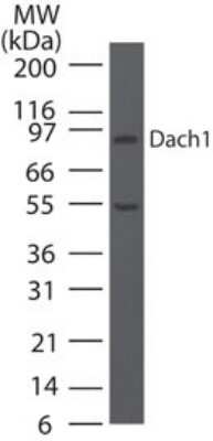 Western Blot: DACH1 Antibody [NBP2-27192]